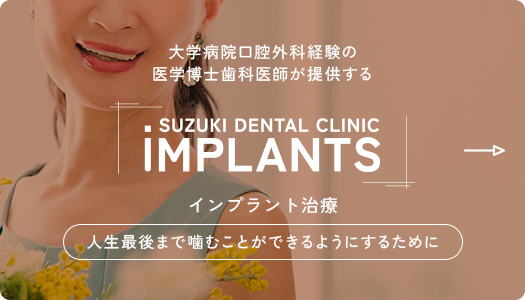 鈴木歯科のインプラント治療
